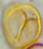 A yellow and purple object

Description automatically generated