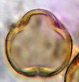 A close-up of a cell

Description automatically generated