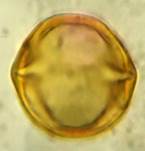 A yellow egg under a microscope

Description automatically generated