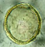 A close-up of a green circle

Description automatically generated