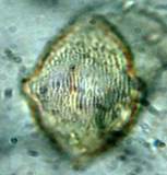 A close-up of a cell

Description automatically generated