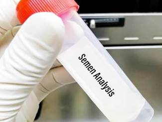 A hand holding a plastic tube with a label
Description automatically generated