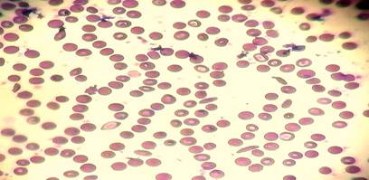 A close-up of red blood cells

Description automatically generated