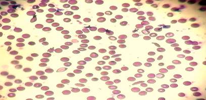 A close-up of red blood cells

Description automatically generated