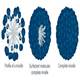 Description: Micelle